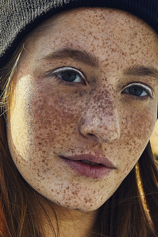 Gesicht mit Sommersprossen
